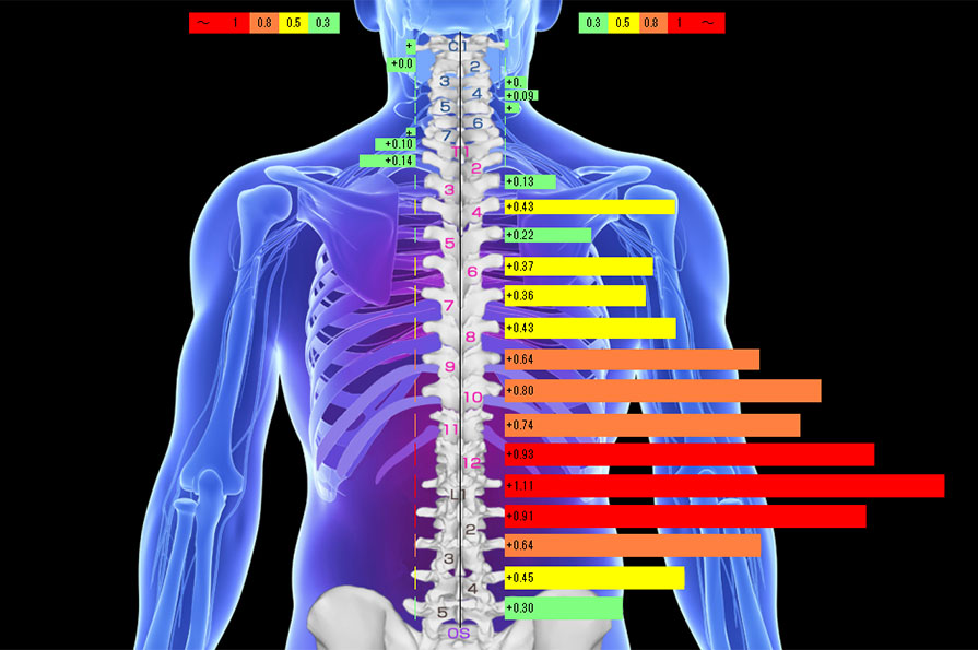 STEP3 スキャンニング(赤外線サーモグラフィー)